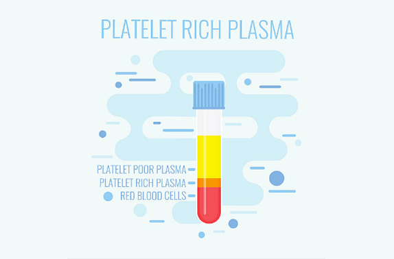 Platelet Rich Plasma